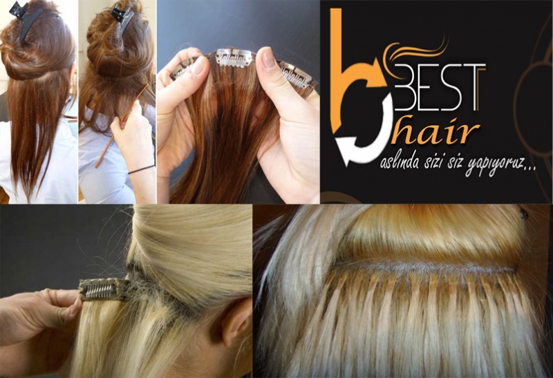 Van Best Hair Saçlandırma Merkezi (protez)
